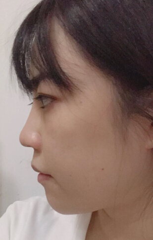 我的鼻子是否需要回炉改造一下呢?