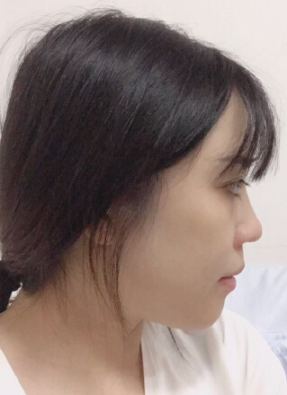 我的鼻子是否需要回炉改造一下呢?