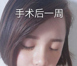 在衢州一家医院做的鼻部手术