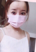 昆明艺星沈婷和尹建兰水光补水，微针，点阵