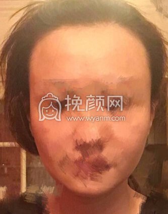 坐标成都,fue2900个单位加密