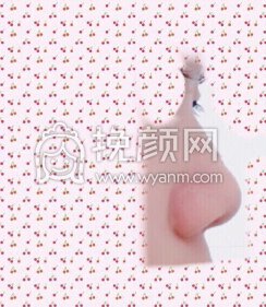 湘雅附二王先成半肋鼻部手术