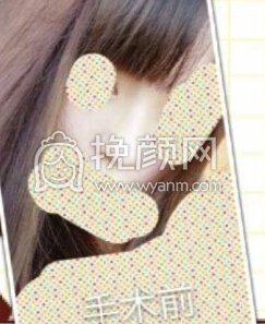 东莞美立方向宏伟医生半肋膨体鼻部手术手术