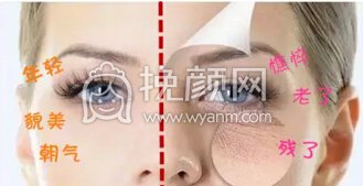 你的眼袋是哪种,该怎么治?