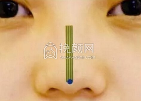 隆鼻操作过程分享
