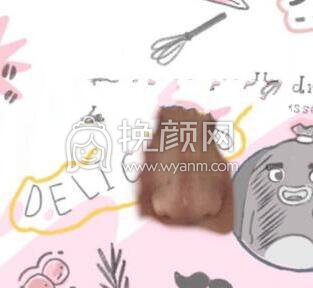 苏州薇琳曹院长做的鼻部手术