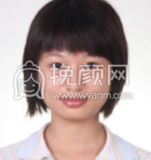 北京中日友好医院李宜磊调节牙体缺损果好不