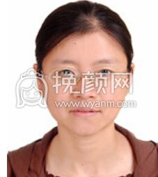 北京八大处整容医院陈建祛除雀斑果好不好