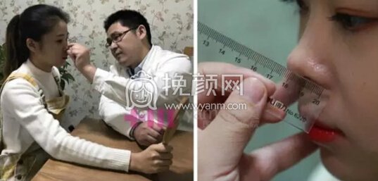 鼻子不好看会毁了整张脸,我就是活生生的例子