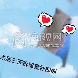 长沙新发现王先成硅胶鼻部手术