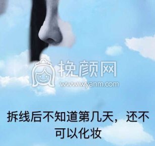 长沙新发现王先成硅胶鼻部手术