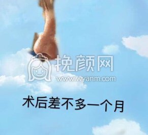 长沙新发现王先成硅胶鼻部手术