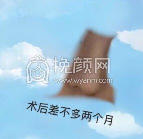 长沙新发现王先成硅胶鼻部手术