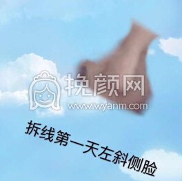长沙新发现王先成硅胶鼻部手术