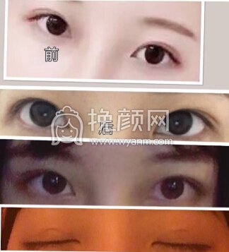 仙女们,要不要修复呢 