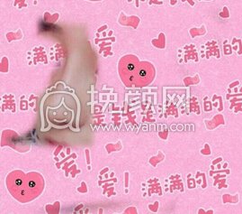 成都娇点李竞医生做的膨体鼻部手术