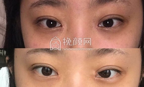 想问一下各位小仙女,我怎么修复比较好?