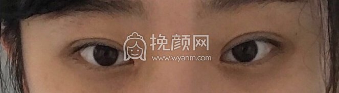 想问一下各位小仙女,我怎么修复比较好?