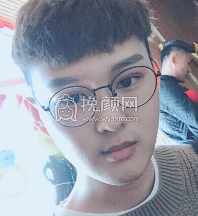 哈尔滨瑞丽整形医院杨永胜鼻子,宋挂霞眼睛