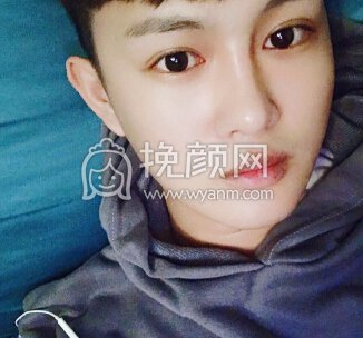 哈尔滨瑞丽整形医院杨永胜鼻子,宋挂霞眼睛