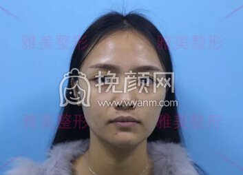 长沙雅美真人测评 十分钟肌肤迅速回春,冬季保