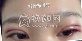 整形医院吕方中执刀手术