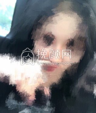 苏州薇琳医美院长曹芳假体、耳软骨取出鼻部手术