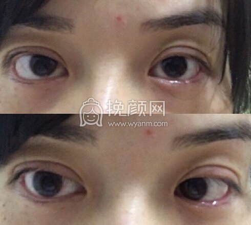 我是否需要做修复?大概需要多少钱?