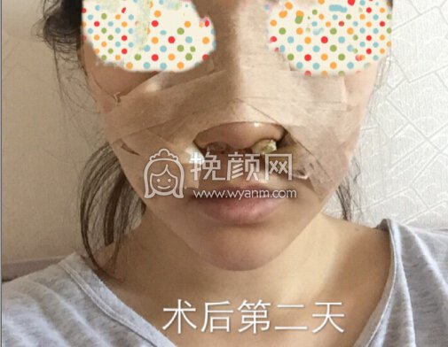 南京东南大学附属中大医院郭宗科鼻部手术整形术