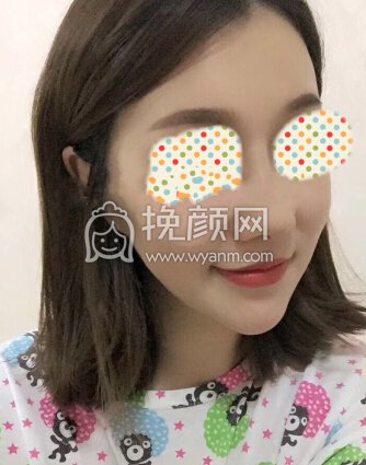 南京东南大学附属中大医院郭宗科鼻部手术整形术