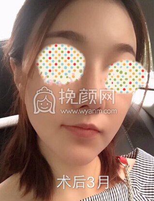 南京东南大学附属中大医院郭宗科鼻部手术整形术