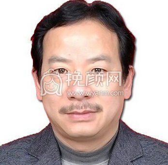 武汉伊美馨整形医院桂际雄治青春痘果好不好