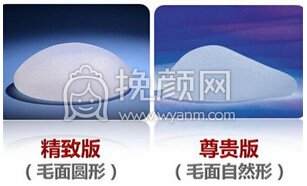 曼托假体隆胸果咋样