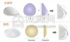假体隆胸假体取出没问题吗