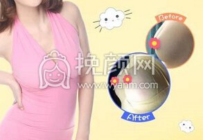 硅胶假体隆胸没问题吗