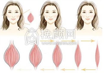 注射瘦脸注射需要多少钱?