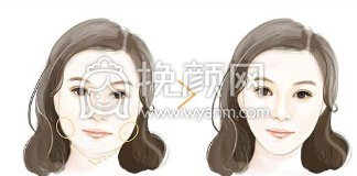 打注射瘦脸的价格是多少钱?