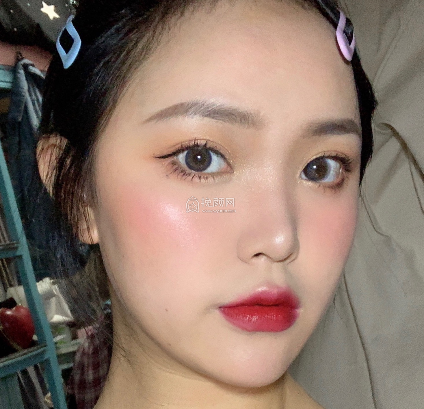 深圳千羽沈婉儿面部吸脂怎么样?真实案例