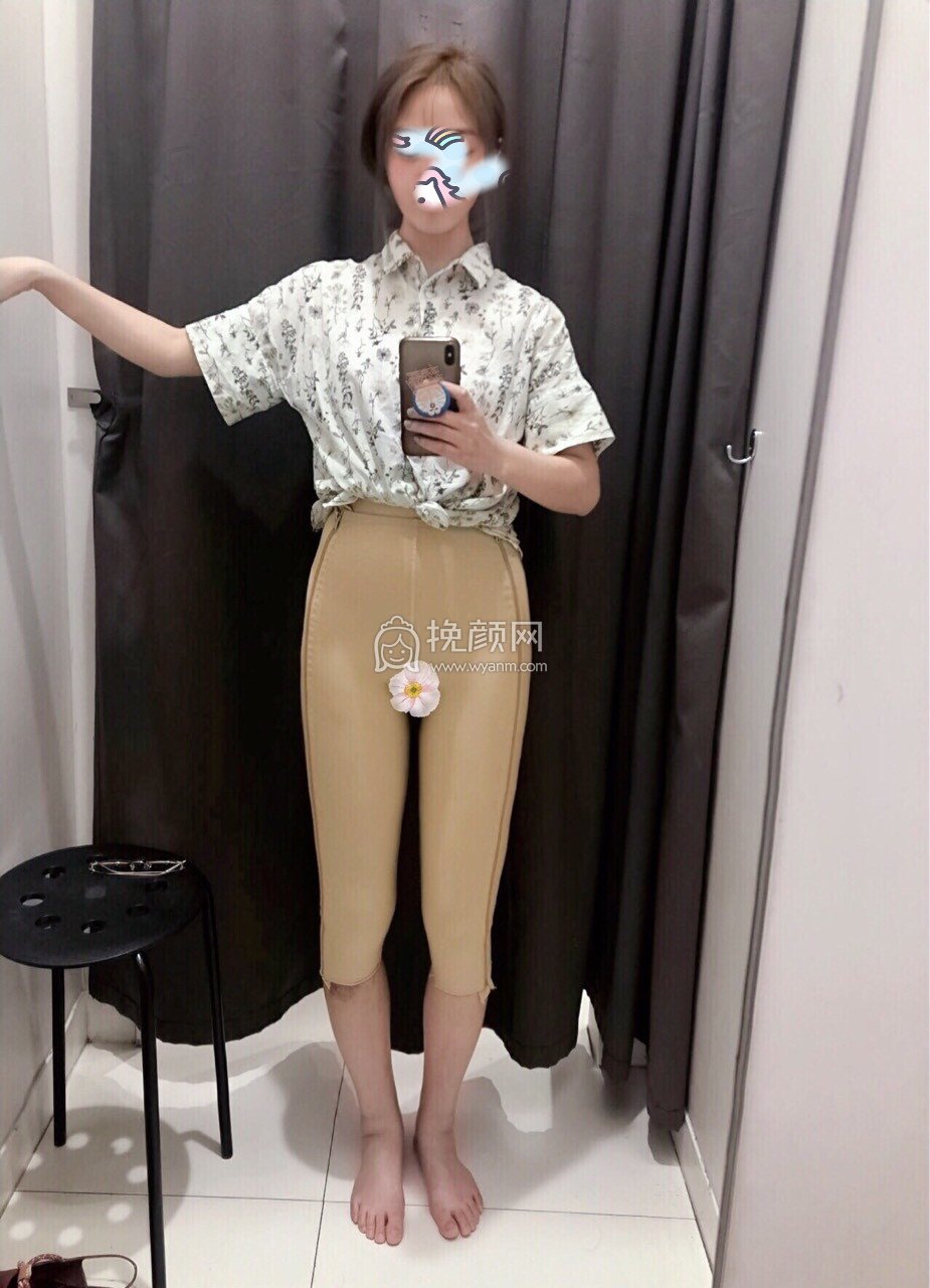 深圳颜美医疗陈东红吸脂怎么样?案例!
