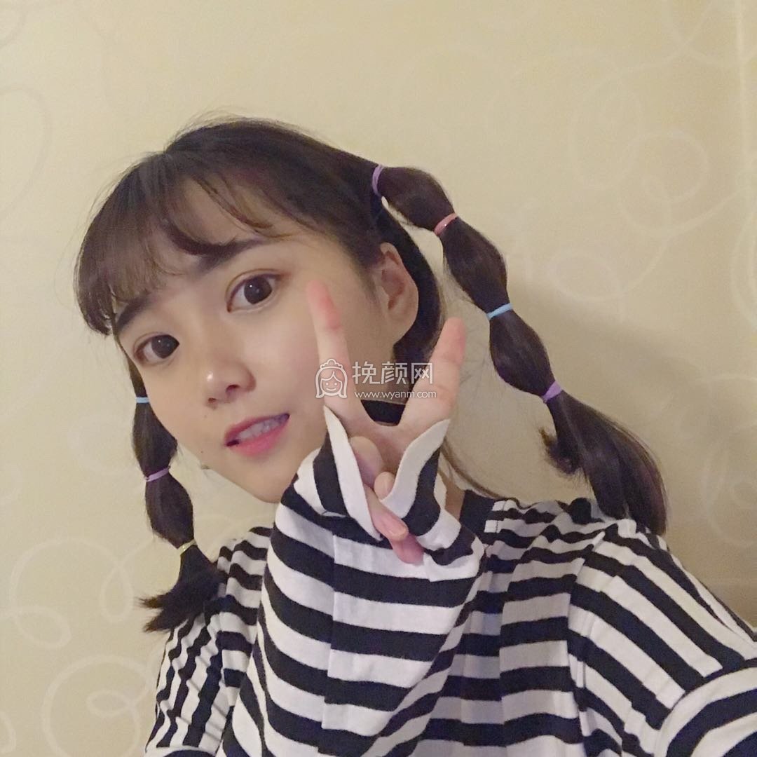 杭州双眼皮:艺星整形杨连华怎么样?附案例