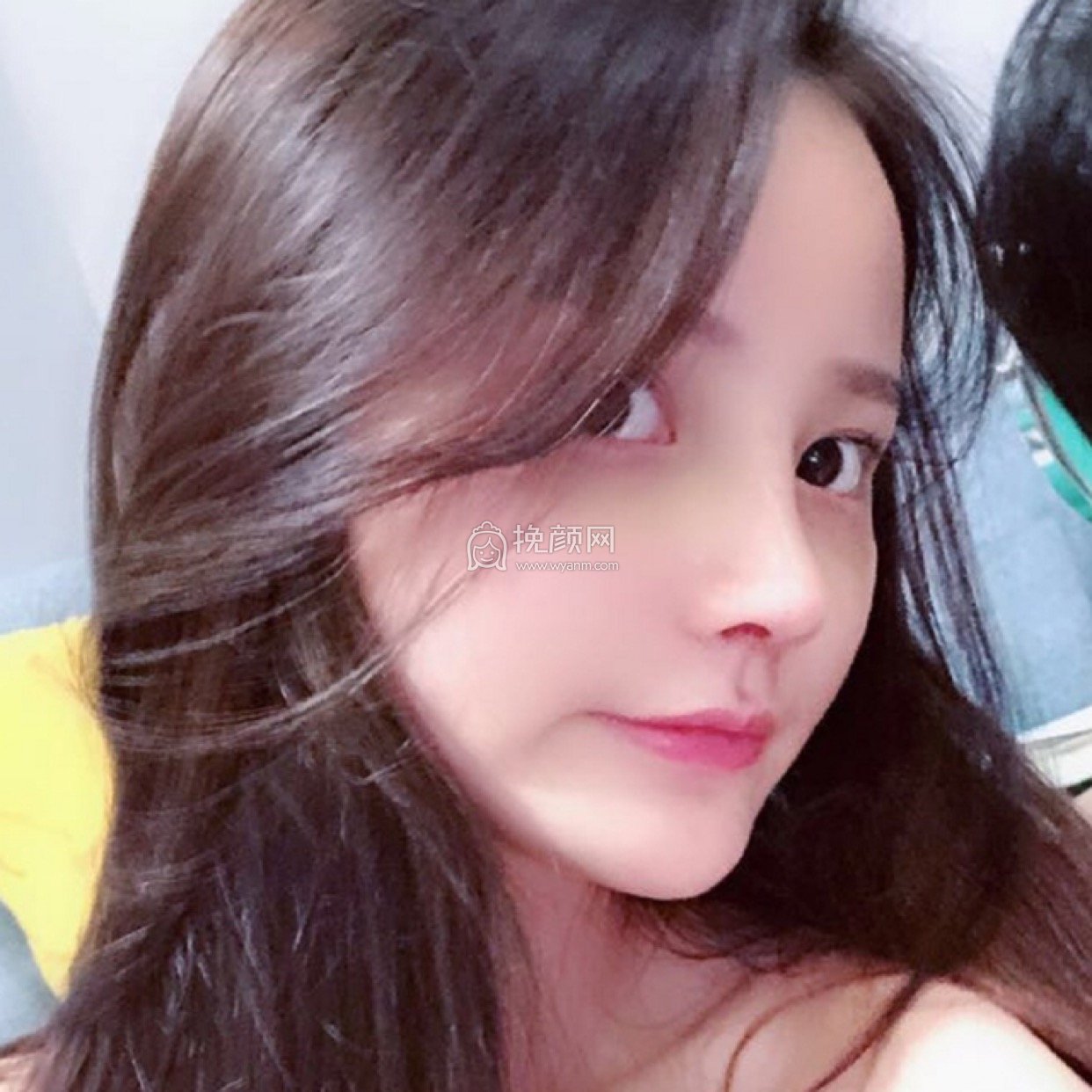 成都奕后刘俊隆鼻好吗?附加案例