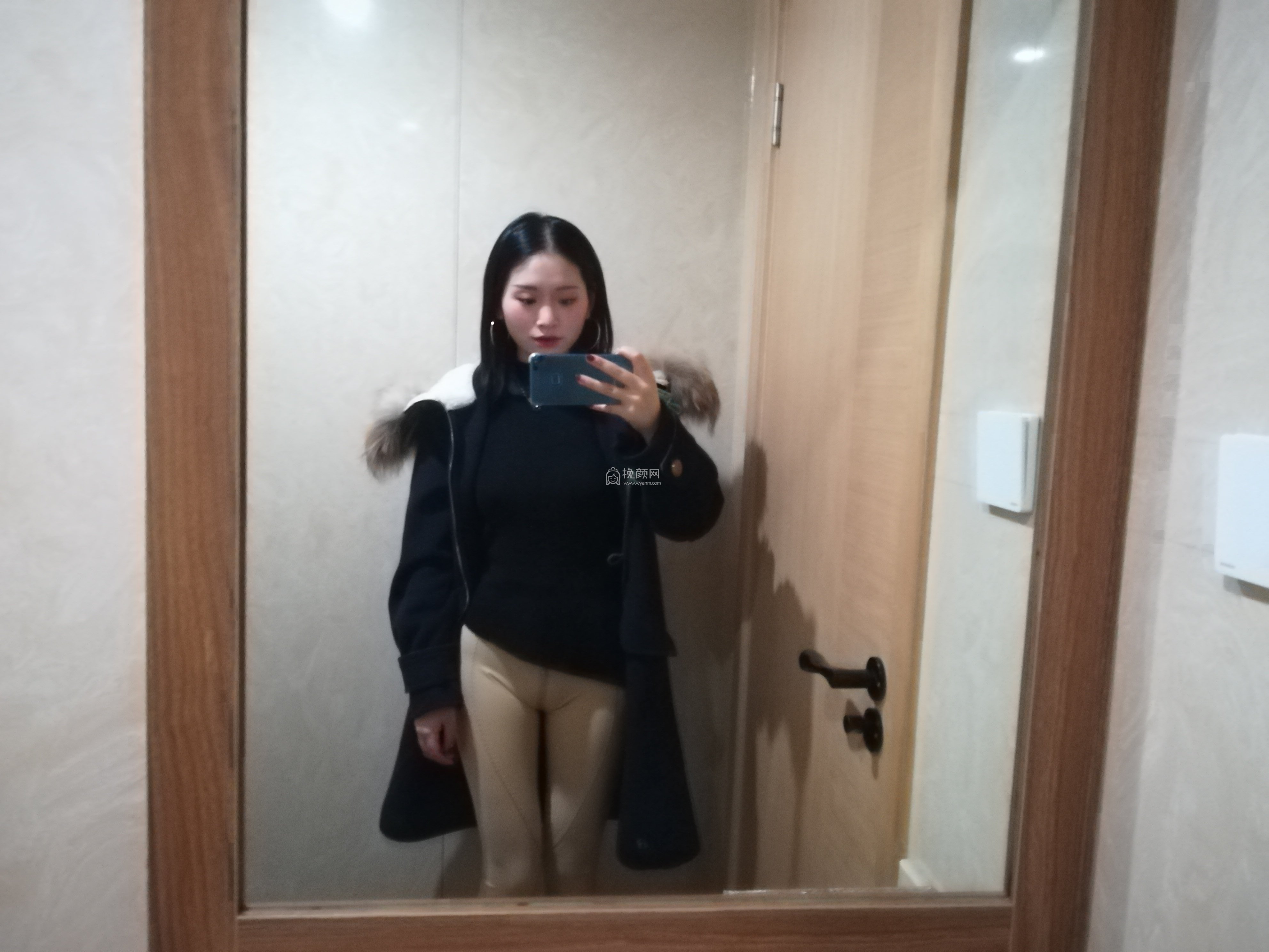 重庆大腿吸脂:江北瑞俪怎么样?真实案例