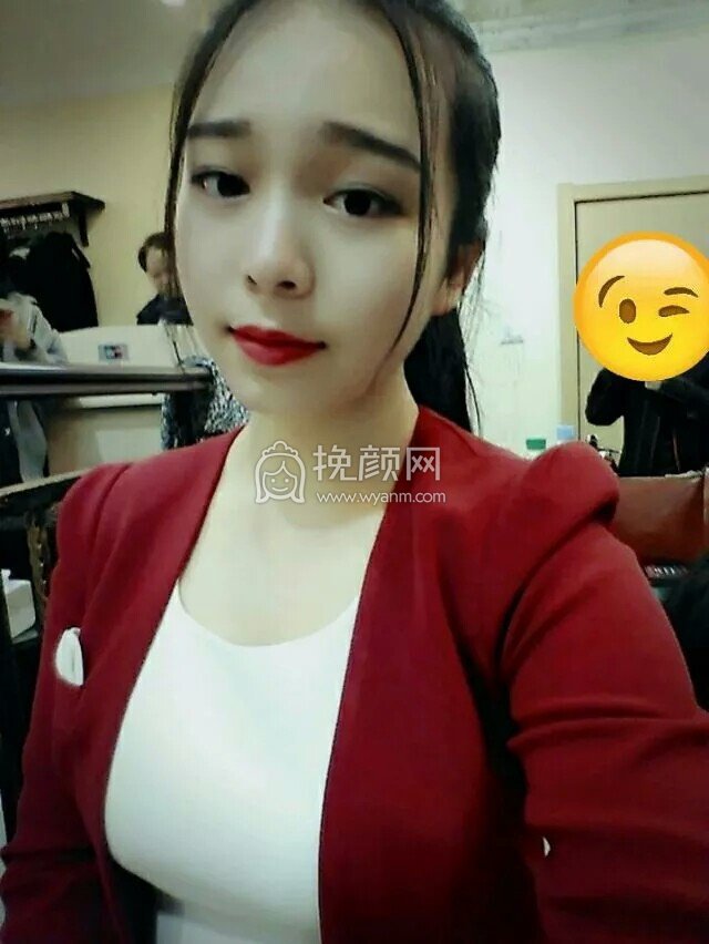 武汉美仑陈远海面部吸脂怎么样?好吗?
