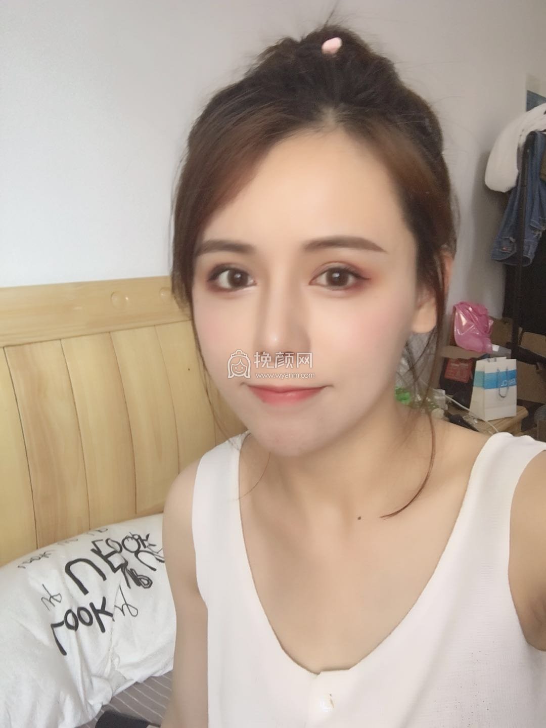 杭州美莱李波隆鼻果怎么样?好吗