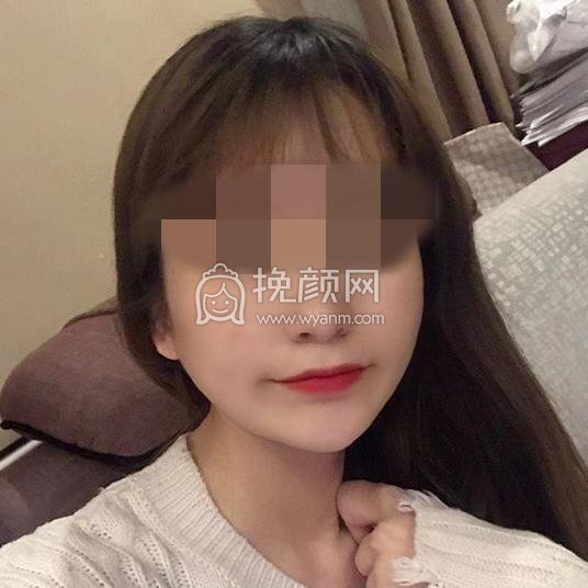 北京圣嘉新医疗张笑天磨骨怎么样?好吗