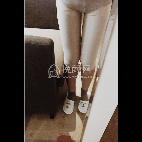 金陵嘉怡美医疗李国伟大吸脂好吗?大腿吸脂