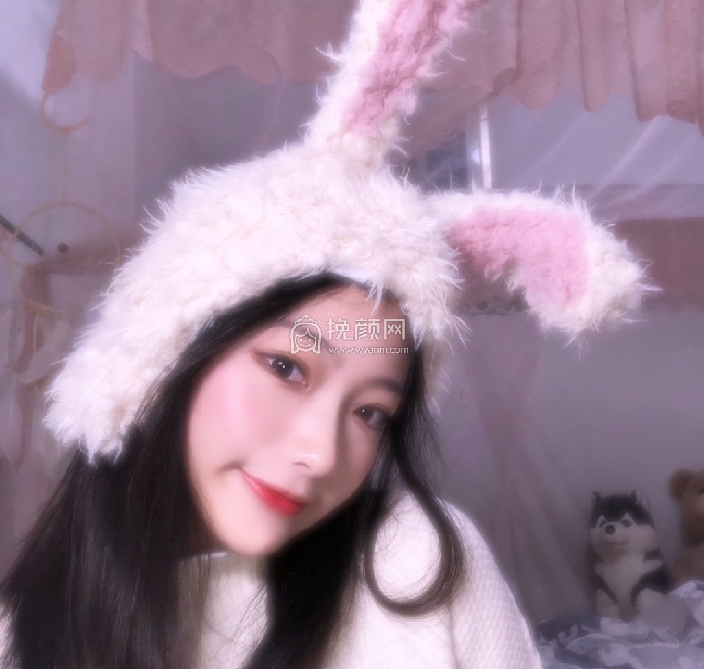 厦门安黛美医疗整形周璟隆鼻好吗?案例