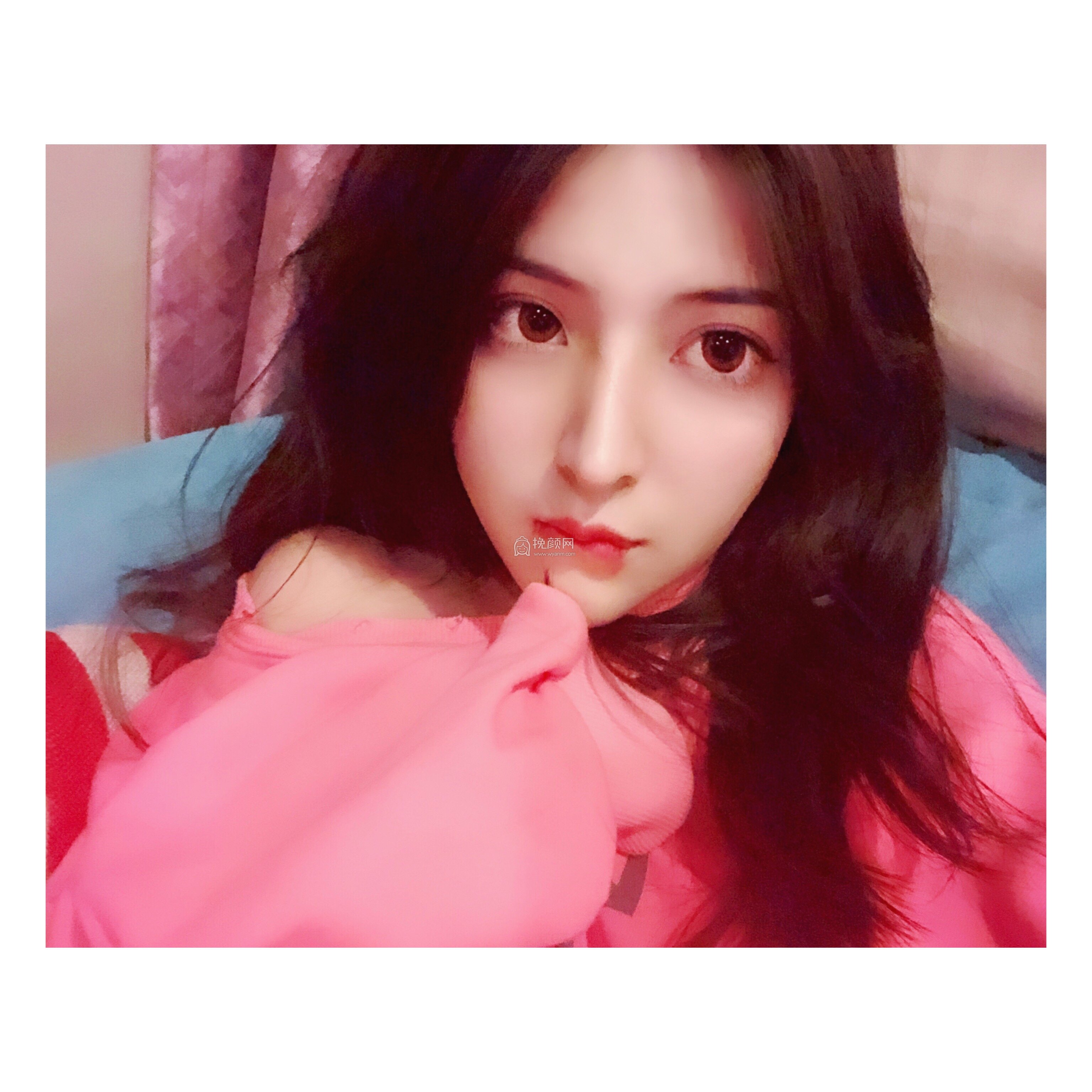 柳州华美医疗王文隆鼻好吗?真实案例
