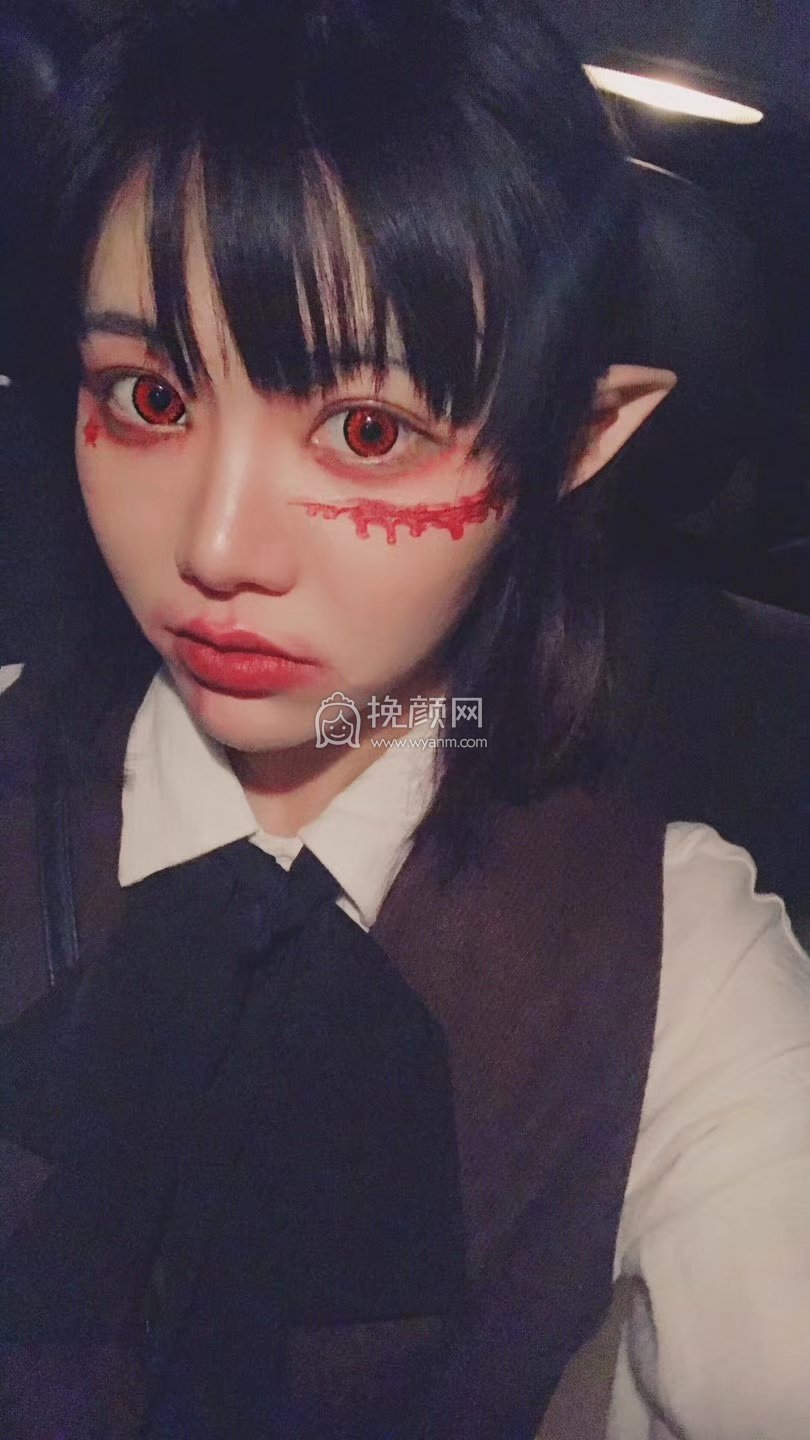 武汉年轻化医疗赵涛隆鼻怎么样？好吗