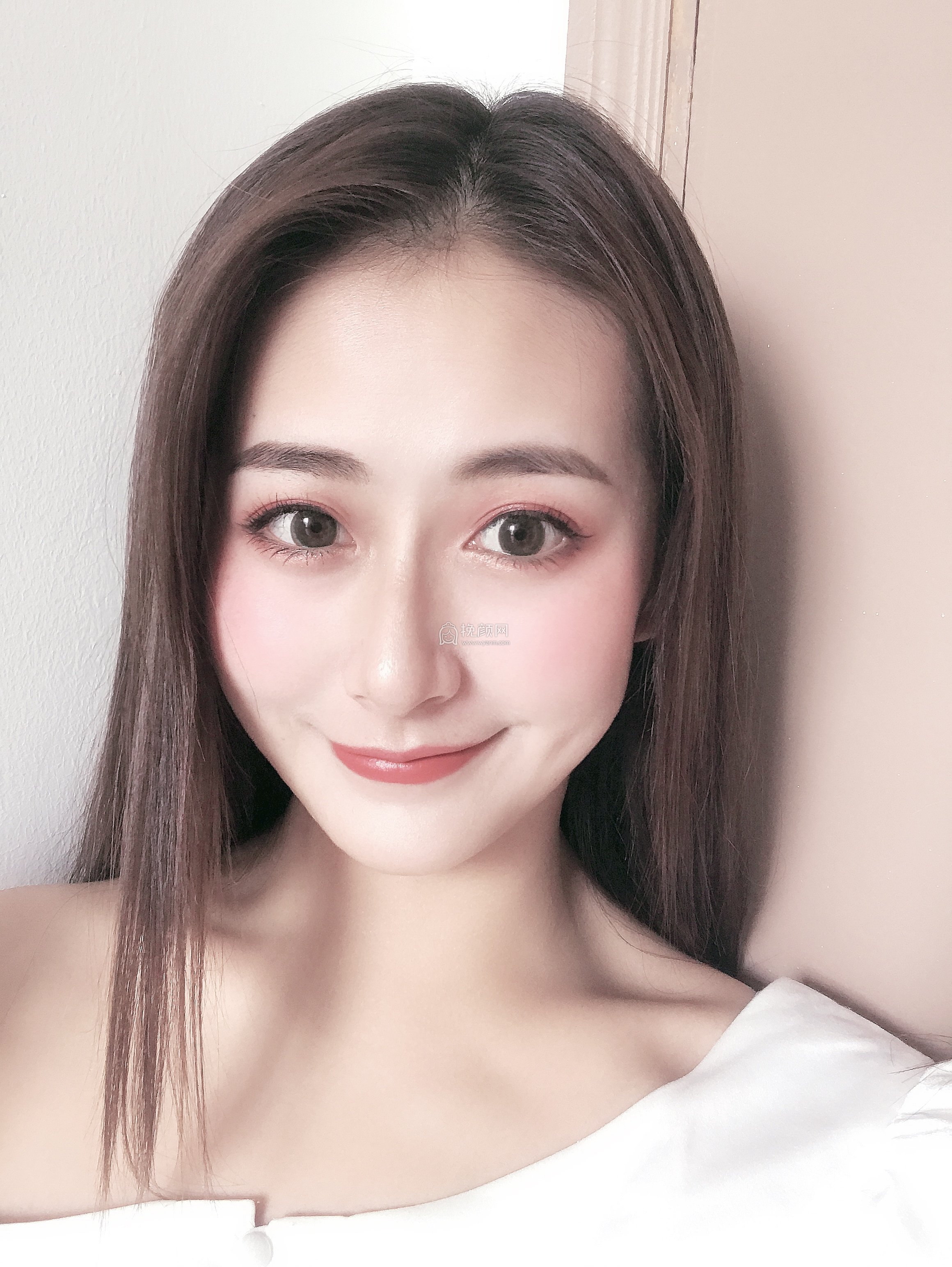 南京美贝尔医疗黄名斗隆鼻好吗?案例分析